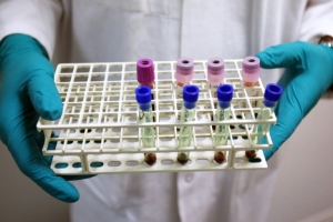 (Arquivo) Um t&eacute;cnico de laborat&oacute;rio segura amostras de sangue para realizar exame anti-doping, em Ch&acirc;tenay-Malabry, no dia 23 de junho de 2008