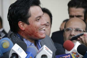 O deputado da oposi&ccedil;&atilde;o venezuelana, Carlos Paparoni, fala com a imprensa depois de ser agredido no Parlamento, em Caracas, no dia 3 de mar&ccedil;o de 2016